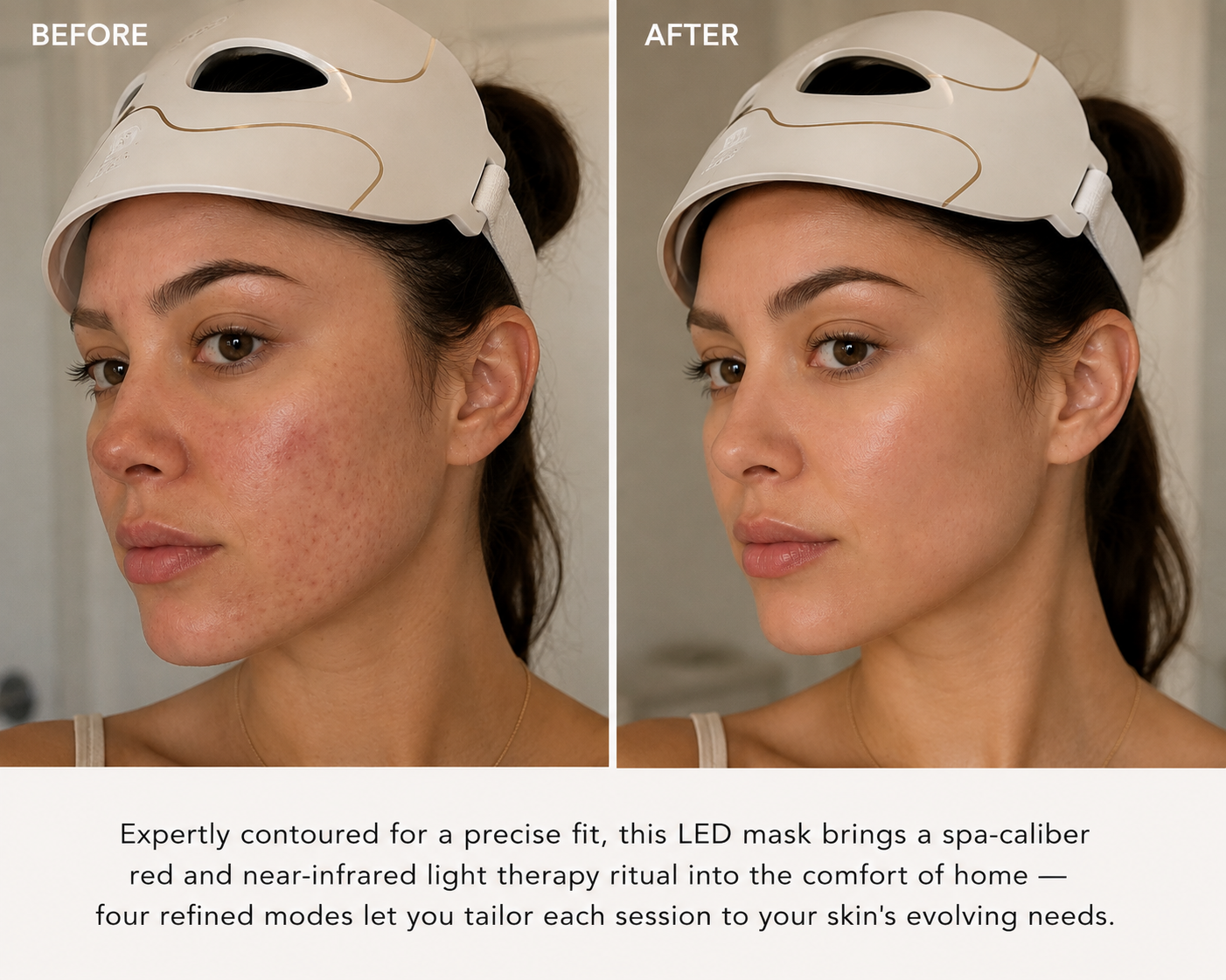 Before and after using the LED red light therapy face mask